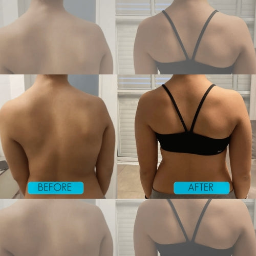 Instant Posture Corrector
