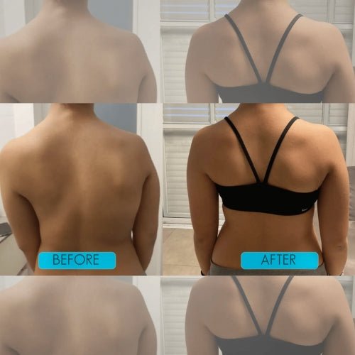Instant Posture Corrector - carelix