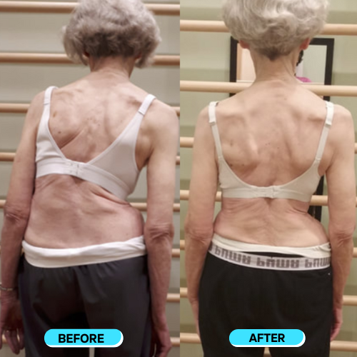 Instant Posture Corrector