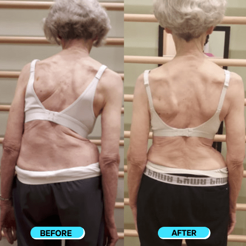 Instant Posture Corrector - carelix