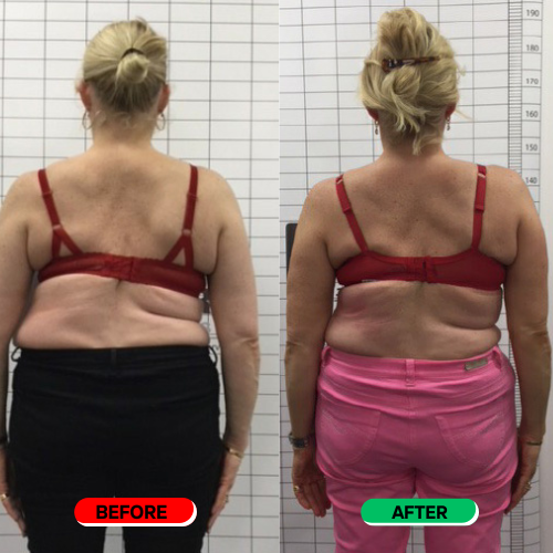 Carelix Spinal Re-adaptation System