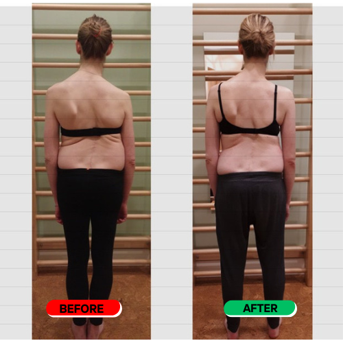 Carelix Spinal Re-adaptation System