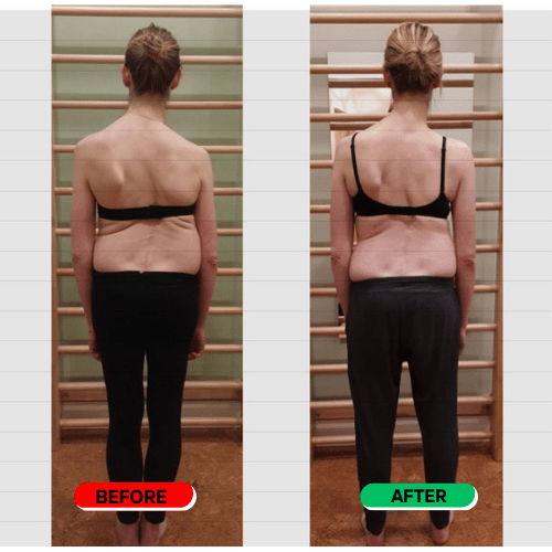 Carelix Spinal Re - adaptation System - carelix