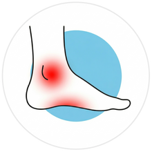 Arch Pain & Flat Feet
