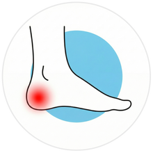 Heel Spurs