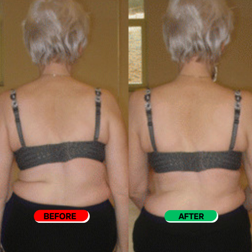 Carelix Spinal Re-adaptation System