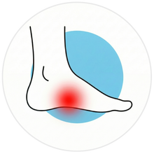 Morning Heel Pain